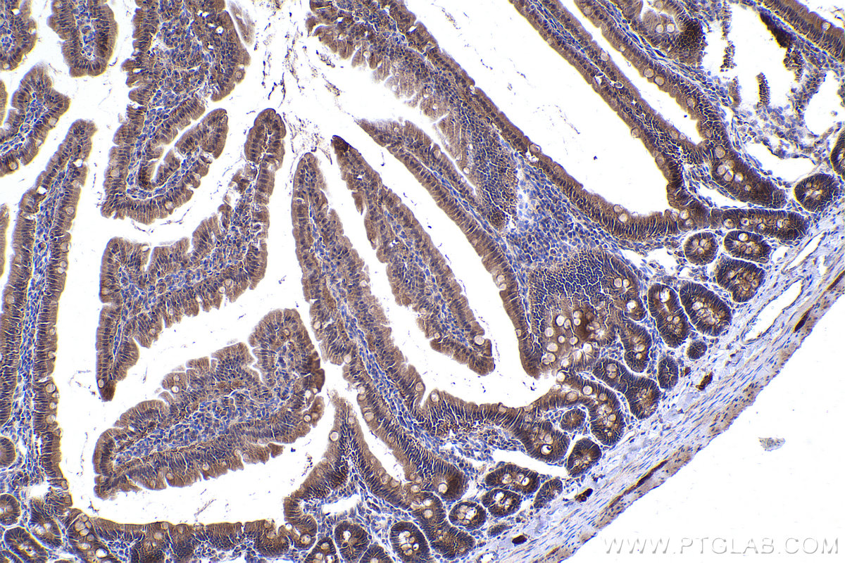 Immunohistochemical analysis of paraffin-embedded rat small intestine tissue slide using KHC2355 (GRB2 IHC Kit).