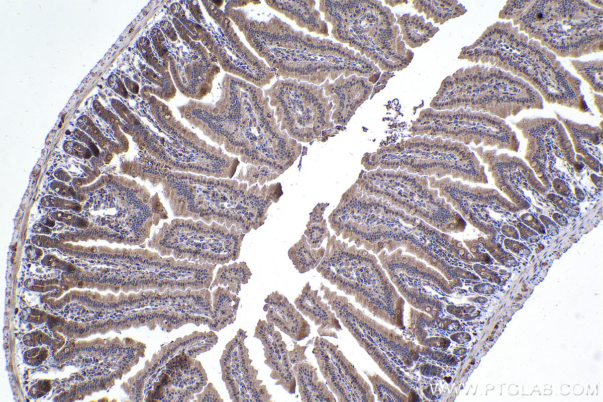 Immunohistochemical analysis of paraffin-embedded mouse small intestine tissue slide using KHC2355 (GRB2 IHC Kit).