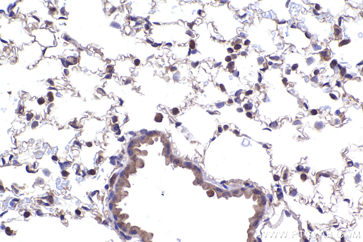 Immunohistochemical analysis of paraffin-embedded mouse lung tissue slide using KHC2355 (GRB2 IHC Kit).