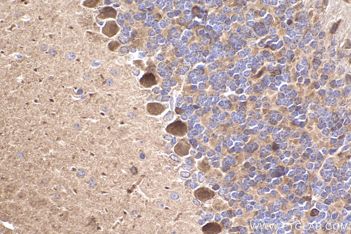 Immunohistochemical analysis of paraffin-embedded mouse cerebellum tissue slide using KHC2355 (GRB2 IHC Kit).