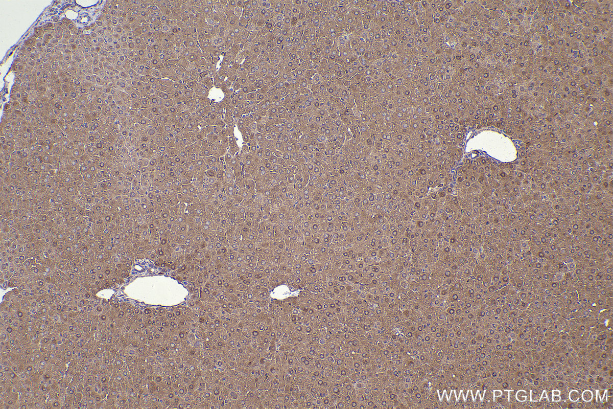 Immunohistochemical analysis of paraffin-embedded mouse liver tissue slide using KHC2332 (GSDMD  IHC Kit).