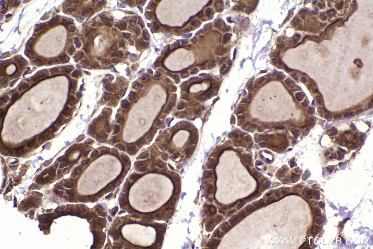 Immunohistochemical analysis of paraffin-embedded rat thyroid gland tissue slide using KHC2332 (GSDMD  IHC Kit).