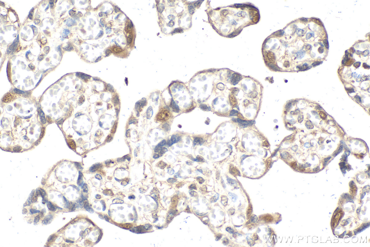 Immunohistochemical analysis of paraffin-embedded human placenta tissue slide using KHC2097 (GSDME/DFNA5 IHC Kit).