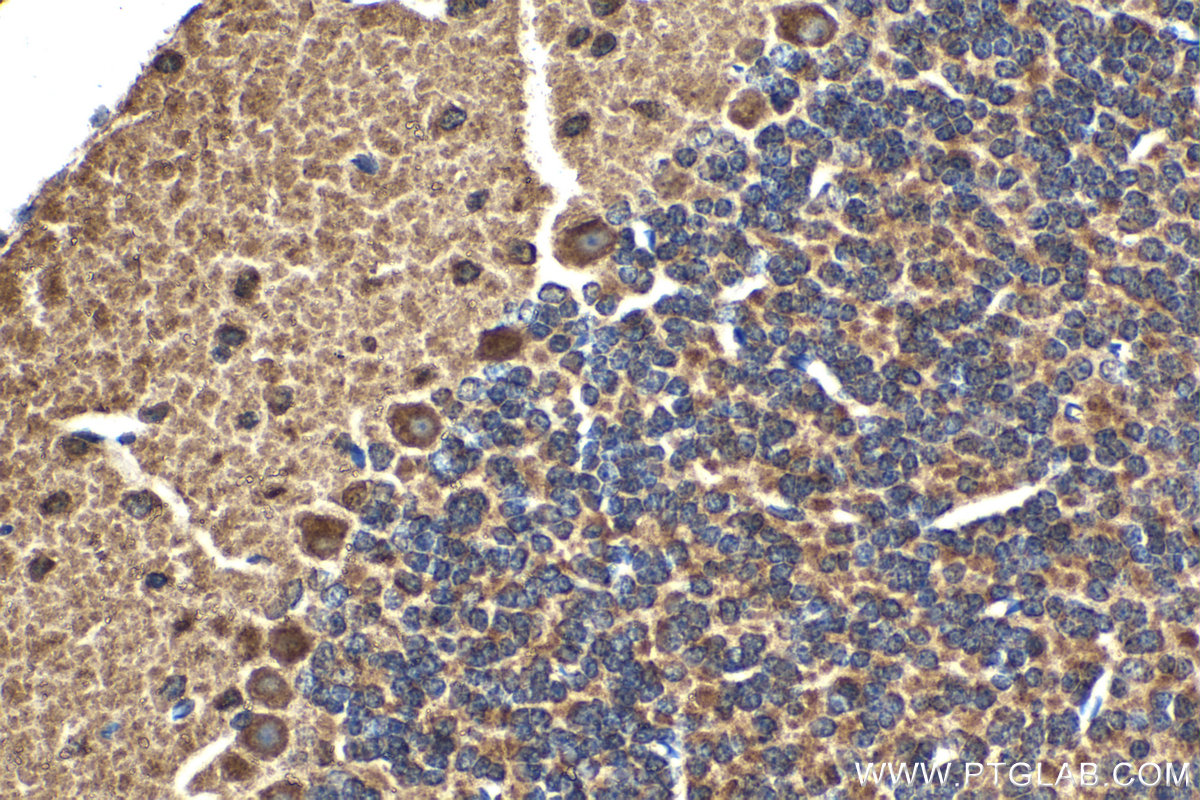 Immunohistochemical analysis of paraffin-embedded mouse cerebellum tissue slide using KHC2097 (GSDME/DFNA5 IHC Kit).