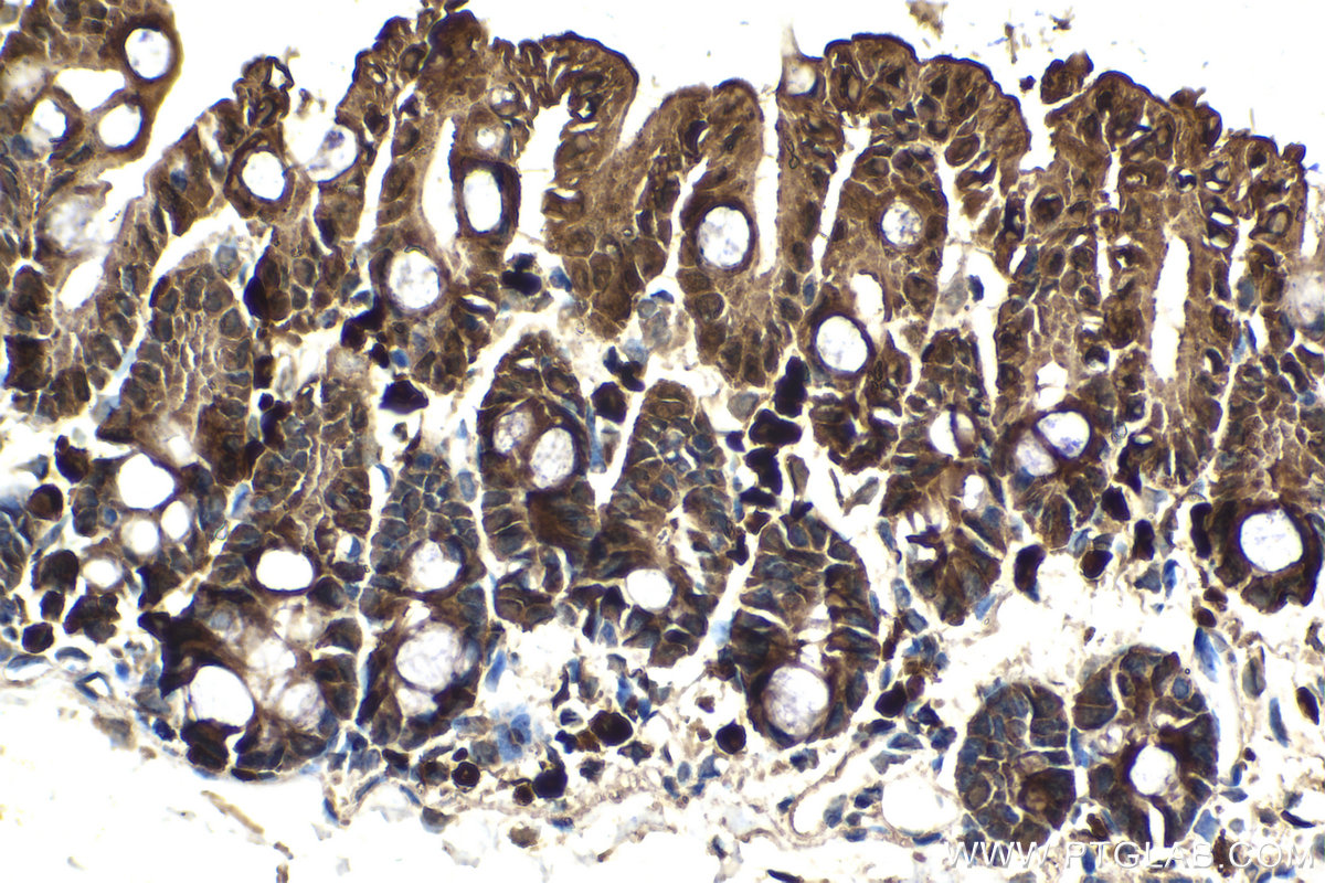 Immunohistochemical analysis of paraffin-embedded mouse small intestine tissue slide using KHC2097 (GSDME/DFNA5 IHC Kit).