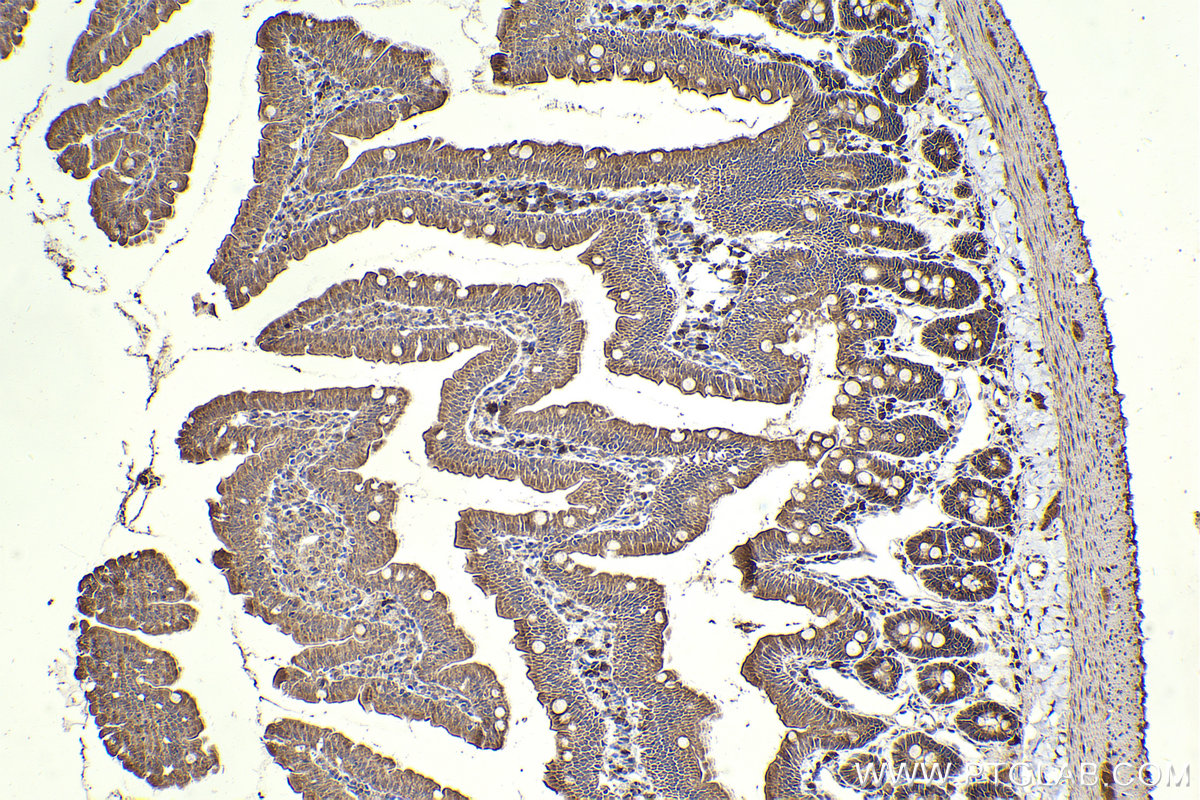 Immunohistochemical analysis of paraffin-embedded rat small intestine tissue slide using KHC2292 (GSK3A IHC Kit).