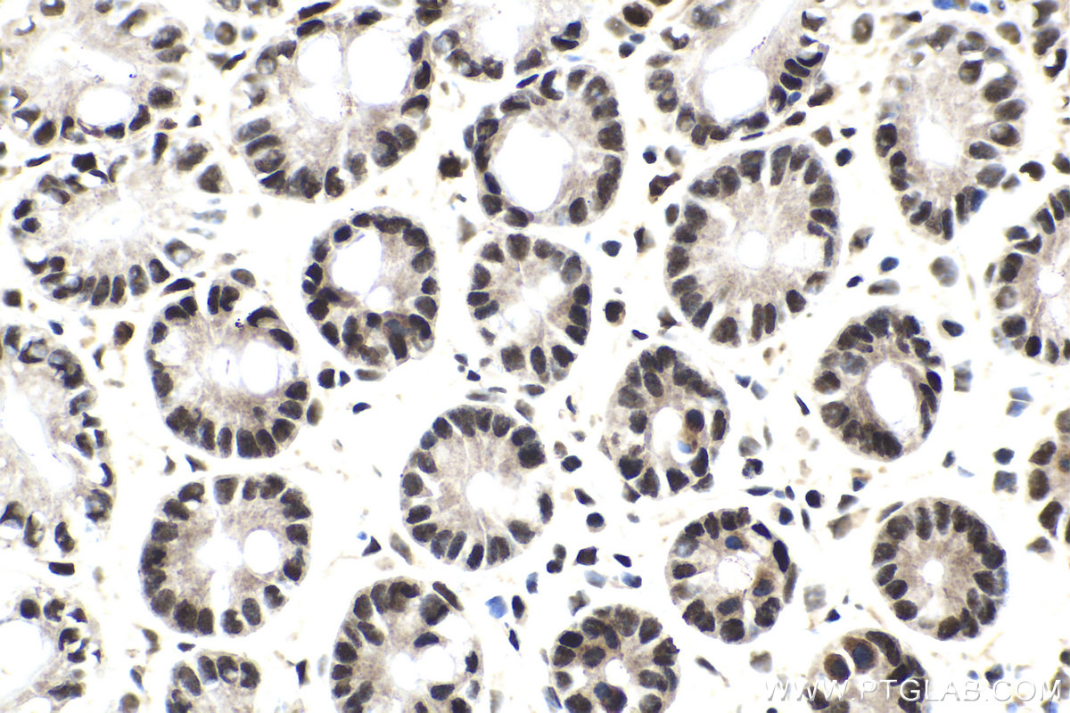 Immunohistochemical analysis of paraffin-embedded mouse small intestine tissue slide using KHC1604 (GTF2E1 IHC Kit).