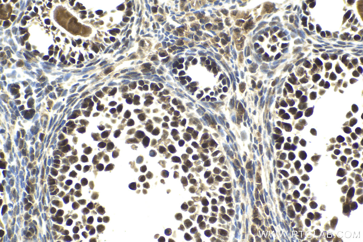 Immunohistochemical analysis of paraffin-embedded mouse ovary tissue slide using KHC1993 (GTF3C4 IHC Kit).