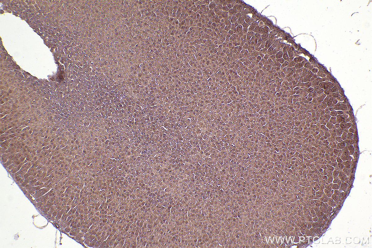 Immunohistochemical analysis of paraffin-embedded mouse adrenal gland tissue slide using KHC2508 (GUK1 IHC Kit).