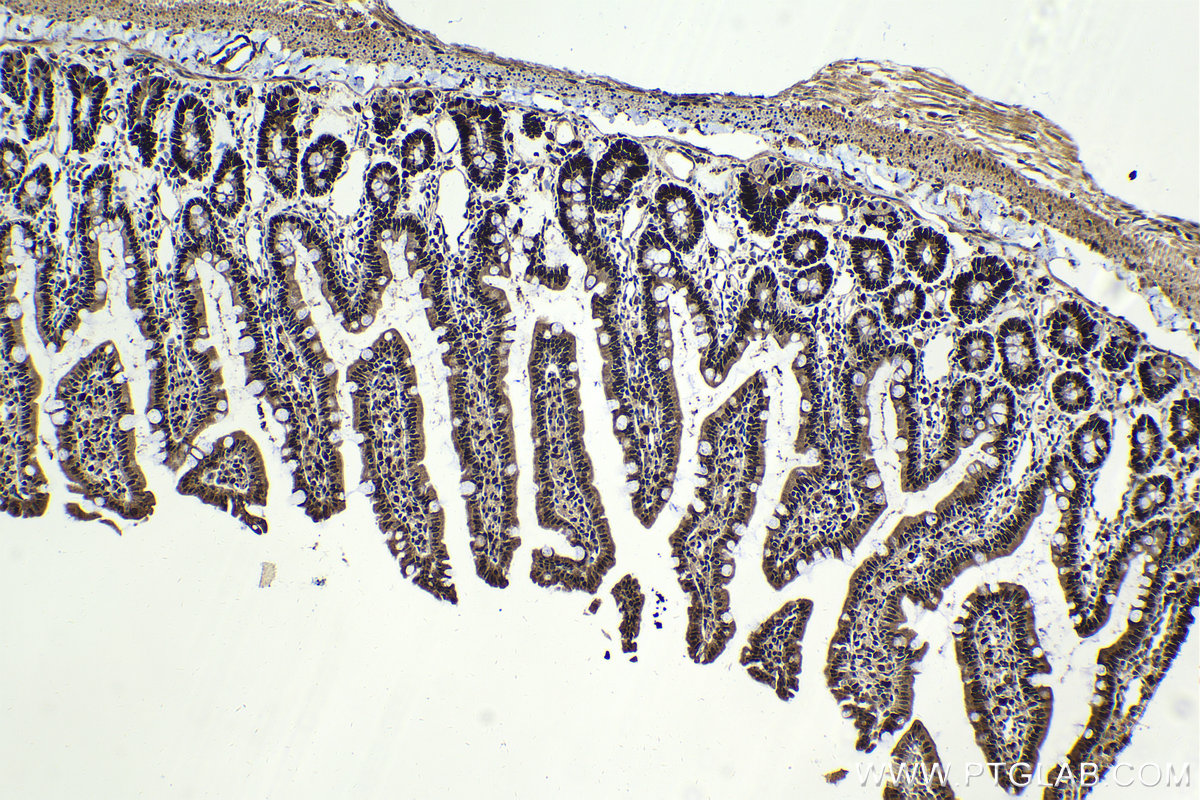 Immunohistochemical analysis of paraffin-embedded rat small intestine tissue slide using KHC2062 (HAT1 IHC Kit).