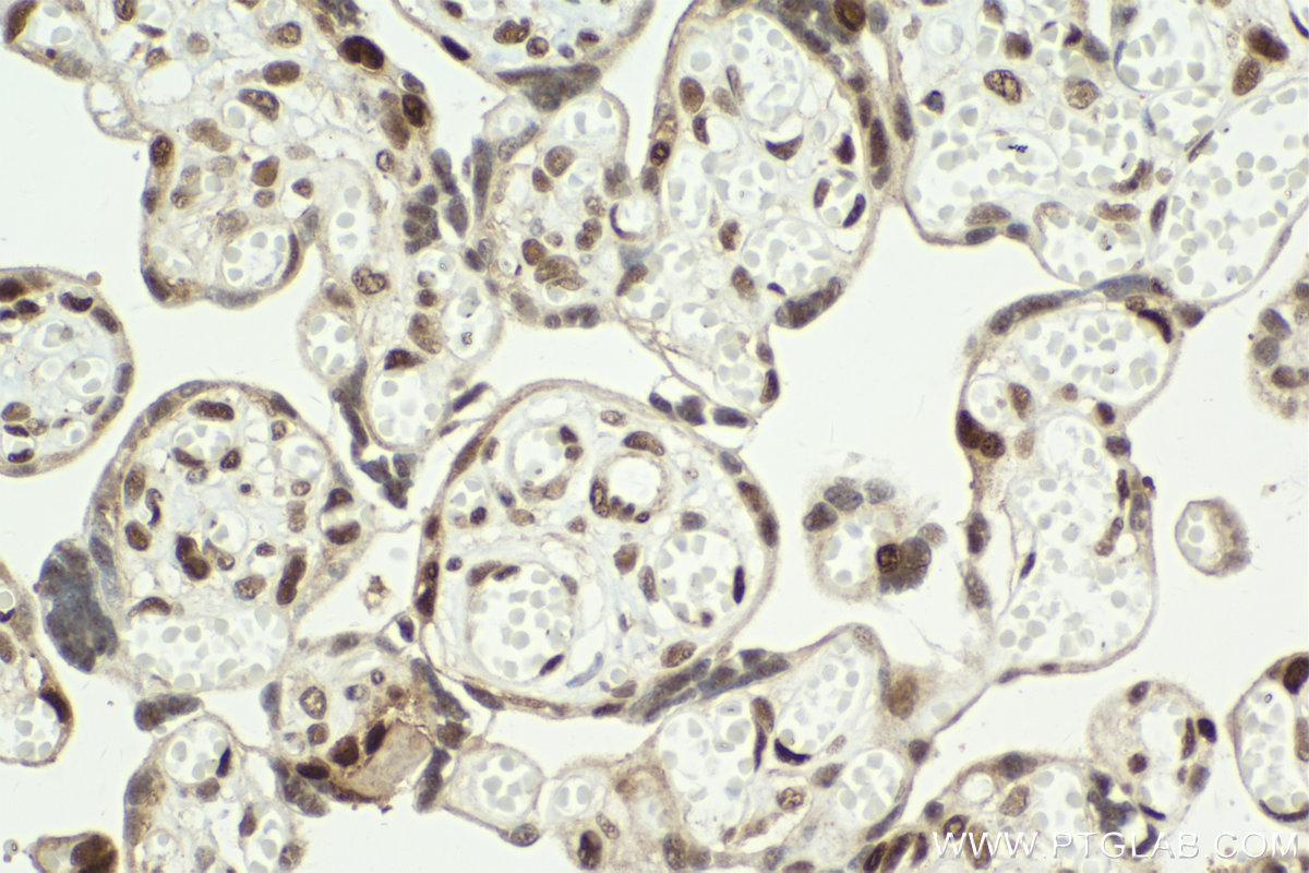 Immunohistochemical analysis of paraffin-embedded human placenta tissue slide using KHC2062 (HAT1 IHC Kit).