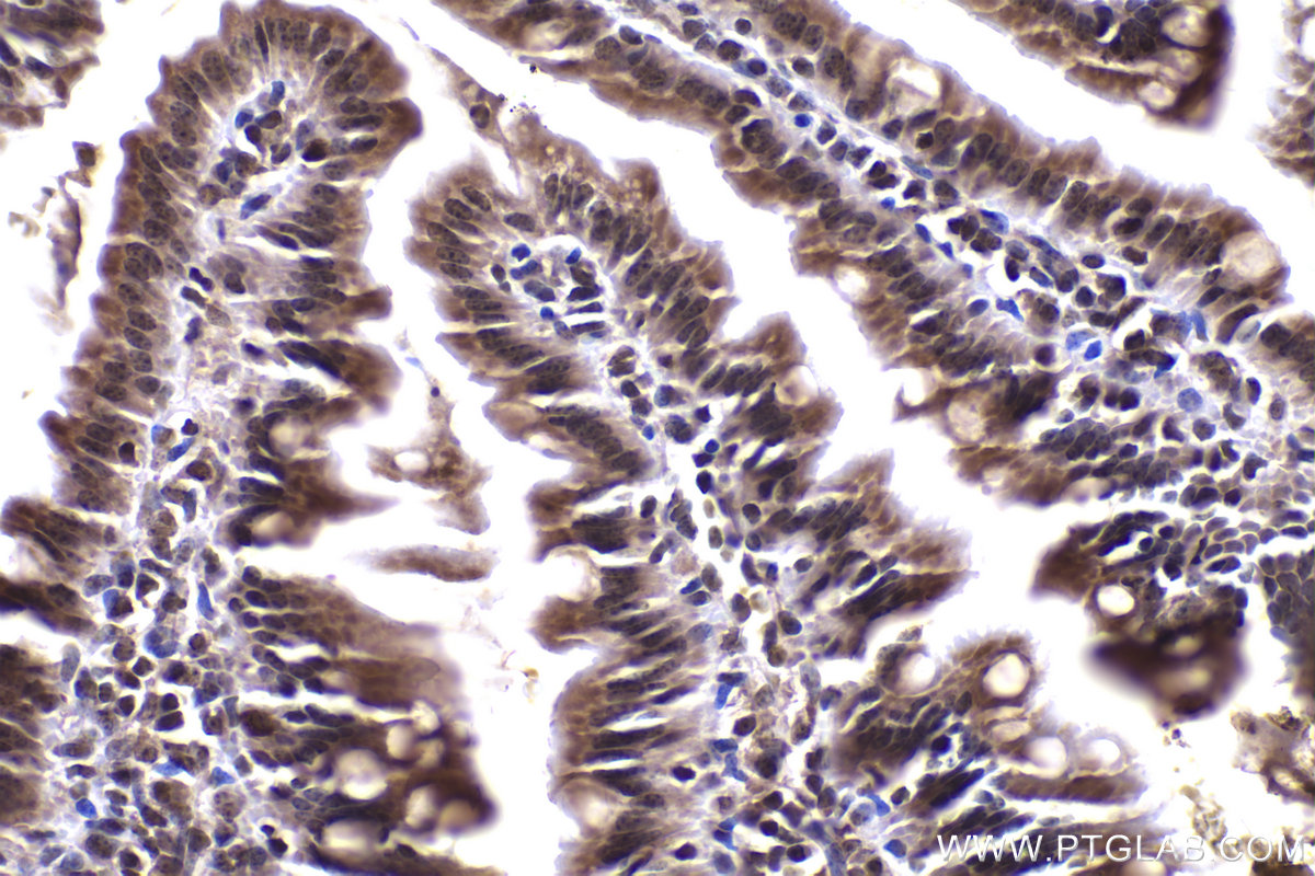 Immunohistochemical analysis of paraffin-embedded mouse small intestine tissue slide using KHC2330 (HDAC4 IHC Kit).