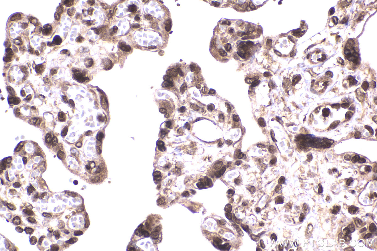 Immunohistochemical analysis of paraffin-embedded human placenta tissue slide using KHC2330 (HDAC4 IHC Kit).