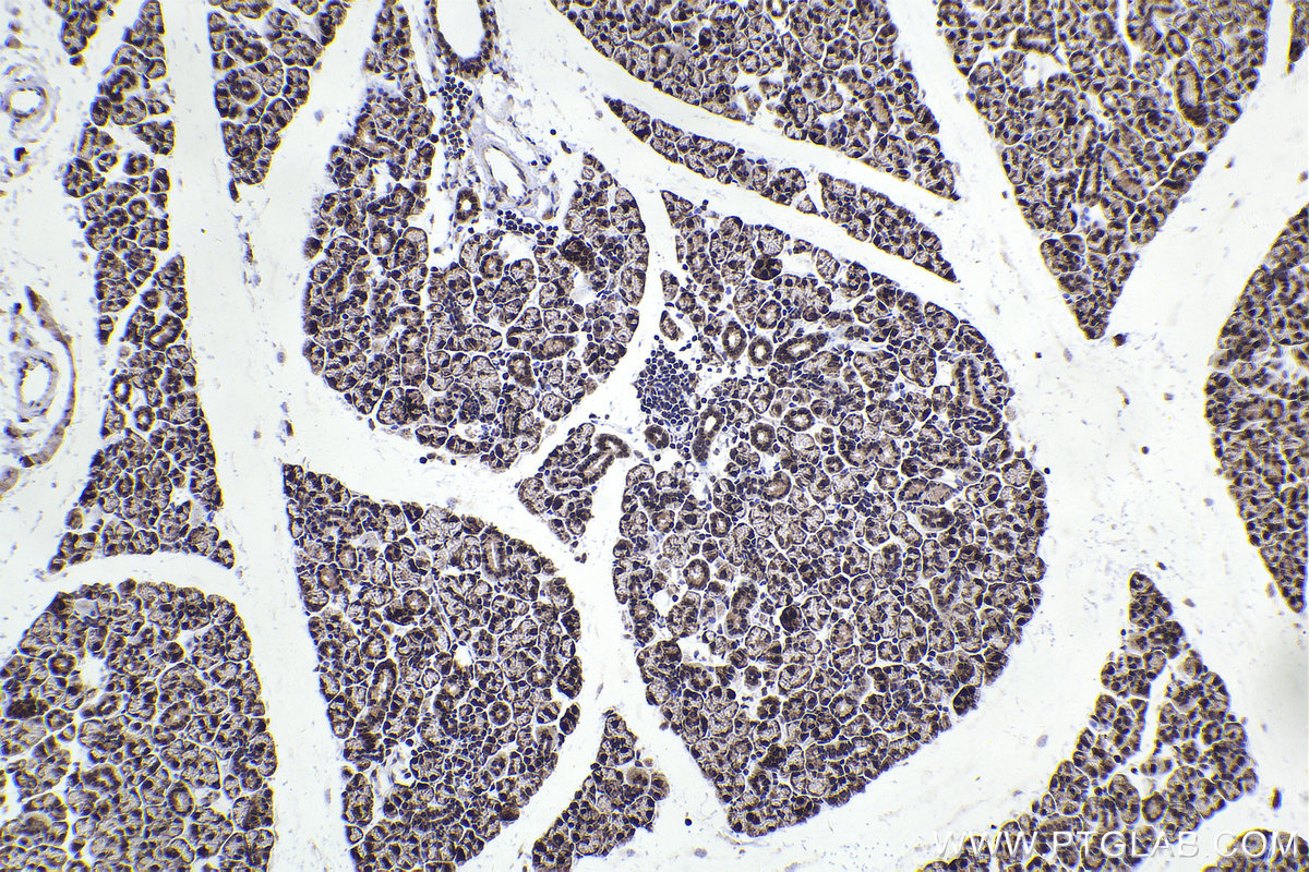 Immunohistochemical analysis of paraffin-embedded mouse salivary gland tissue slide using KHC2330 (HDAC4 IHC Kit).