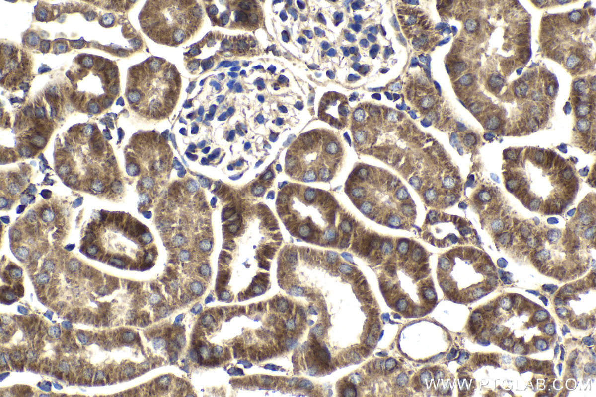Immunohistochemical analysis of paraffin-embedded mouse kidney tissue slide using KHC2036 (HDDC2 IHC Kit).