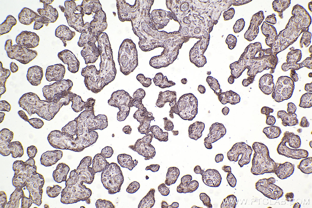 Immunohistochemical analysis of paraffin-embedded human placenta tissue slide using KHC2553 (HECTD3 IHC Kit).