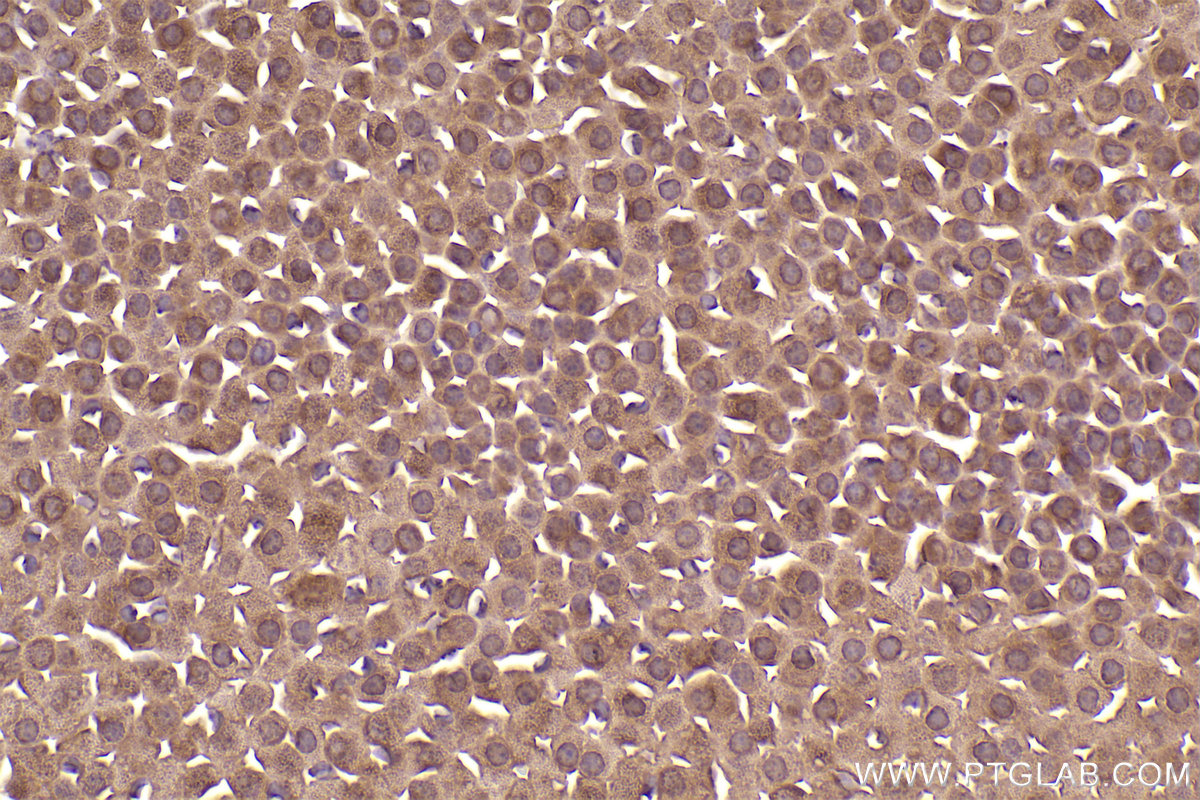 Immunohistochemical analysis of paraffin-embedded mouse adrenal gland tissue slide using KHC2553 (HECTD3 IHC Kit).