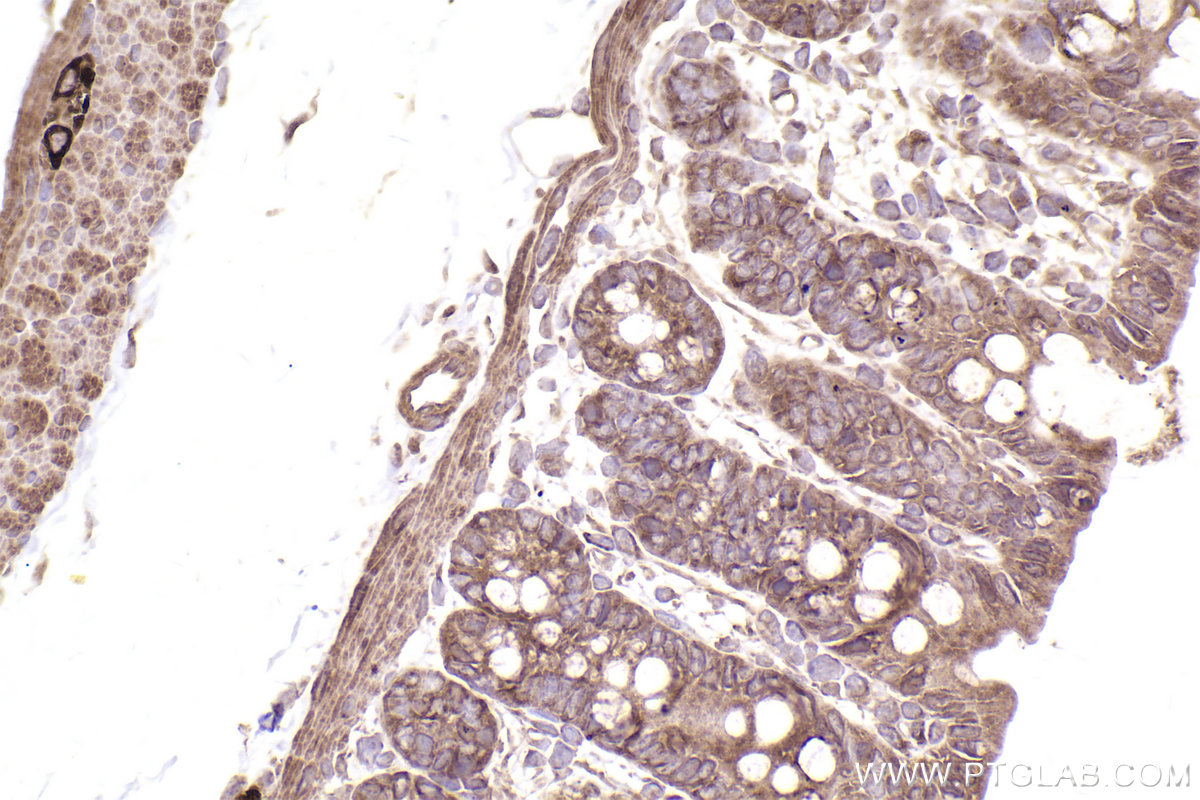 Immunohistochemical analysis of paraffin-embedded rat colon tissue slide using KHC2553 (HECTD3 IHC Kit).