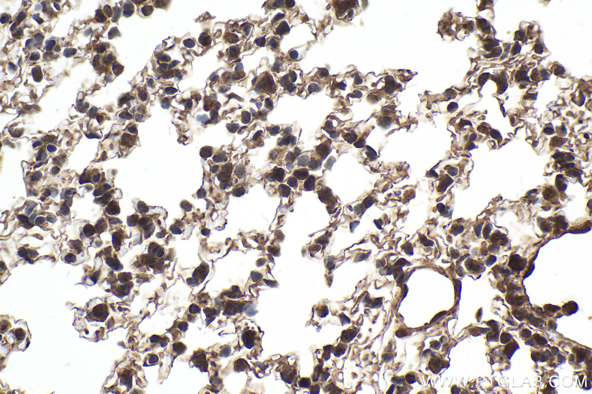 Immunohistochemical analysis of paraffin-embedded mouse lung tissue slide using KHC2016 (HIF3A IHC Kit).