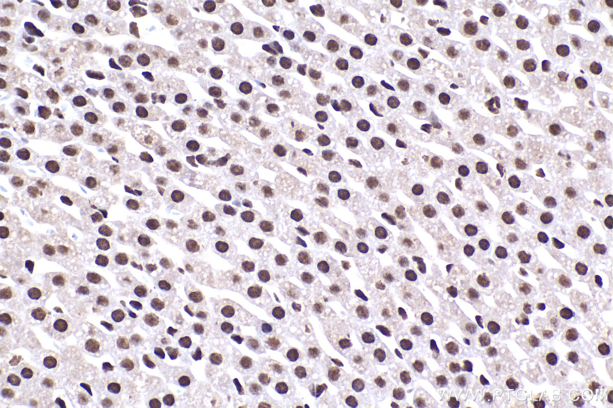 Immunohistochemical analysis of paraffin-embedded rat adrenal gland tissue slide using KHC2236 (HNRNPH1 IHC Kit).