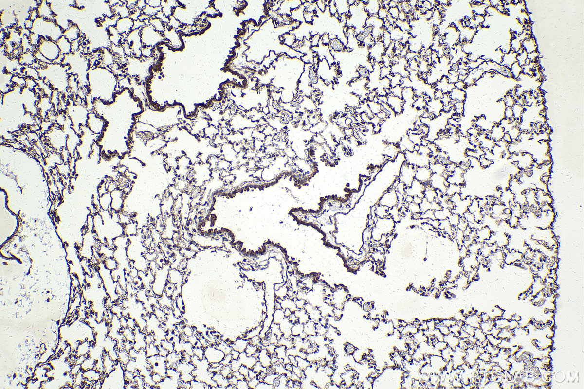 Immunohistochemical analysis of paraffin-embedded mouse lung tissue slide using KHC2190 (HPGD IHC Kit).