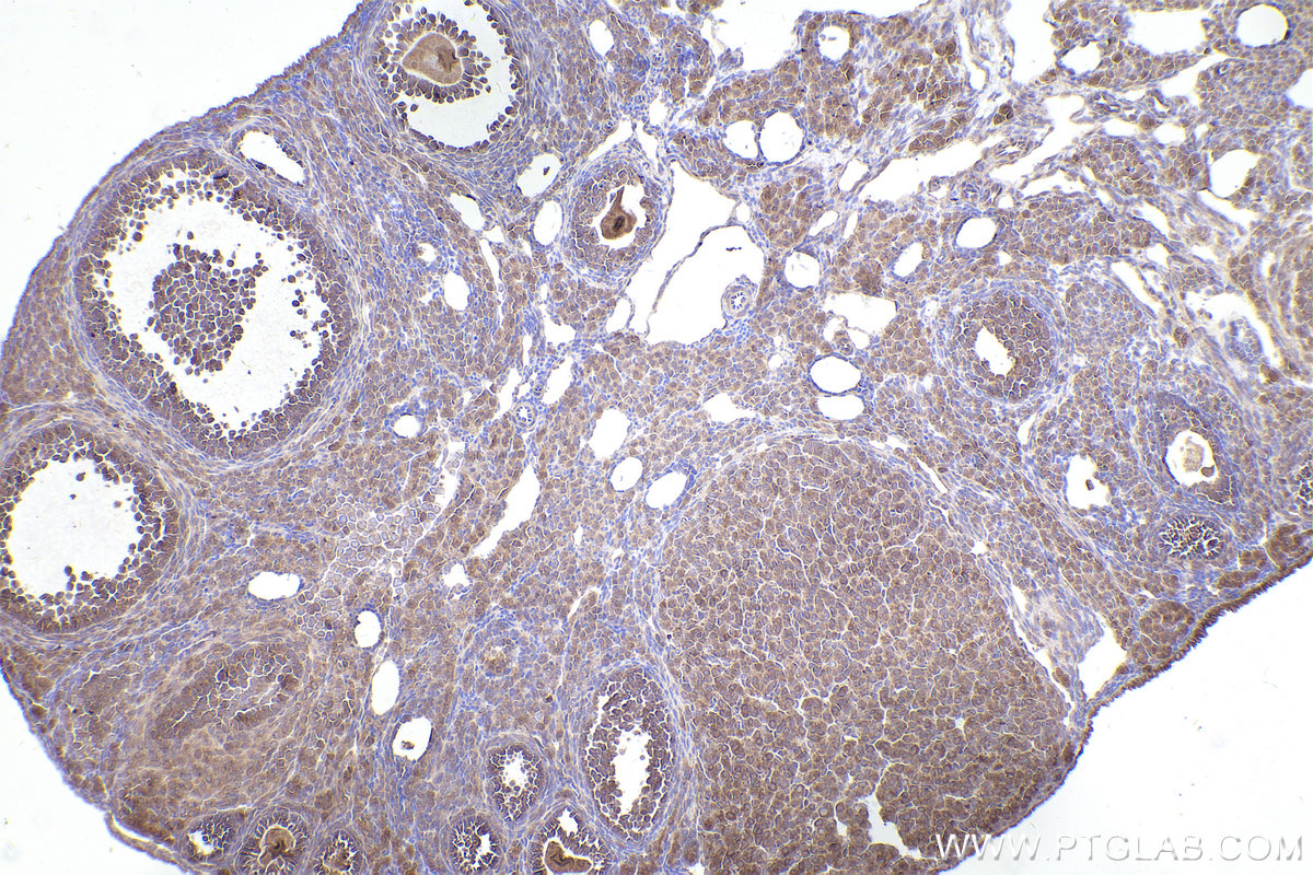 Immunohistochemical analysis of paraffin-embedded mouse ovary tissue slide using KHC2534 (HSD17B12 IHC Kit).