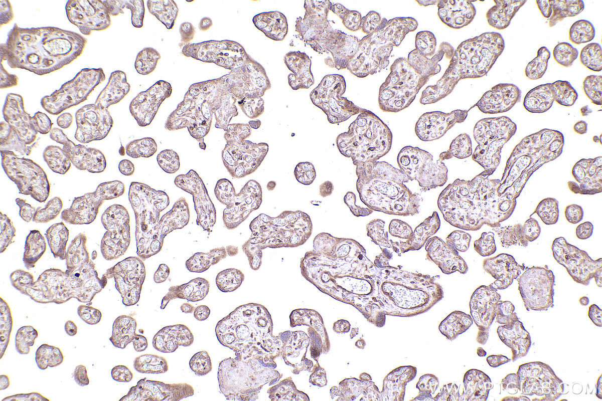 Immunohistochemical analysis of paraffin-embedded human placenta tissue slide using KHC2534 (HSD17B12 IHC Kit).