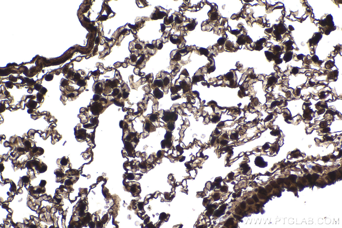 Immunohistochemical analysis of paraffin-embedded mouse lung tissue slide using KHC2243 (HSPA1L IHC Kit).