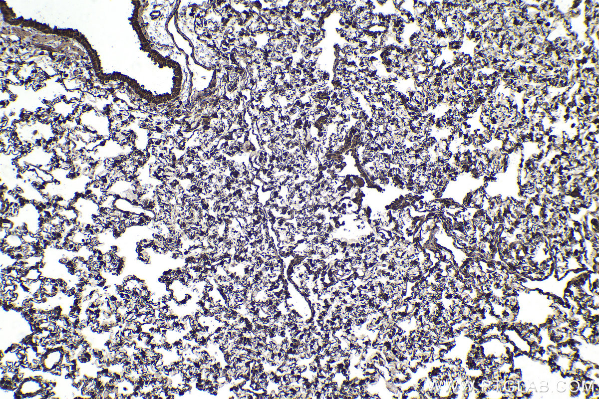 Immunohistochemical analysis of paraffin-embedded rat lung tissue slide using KHC2243 (HSPA1L IHC Kit).