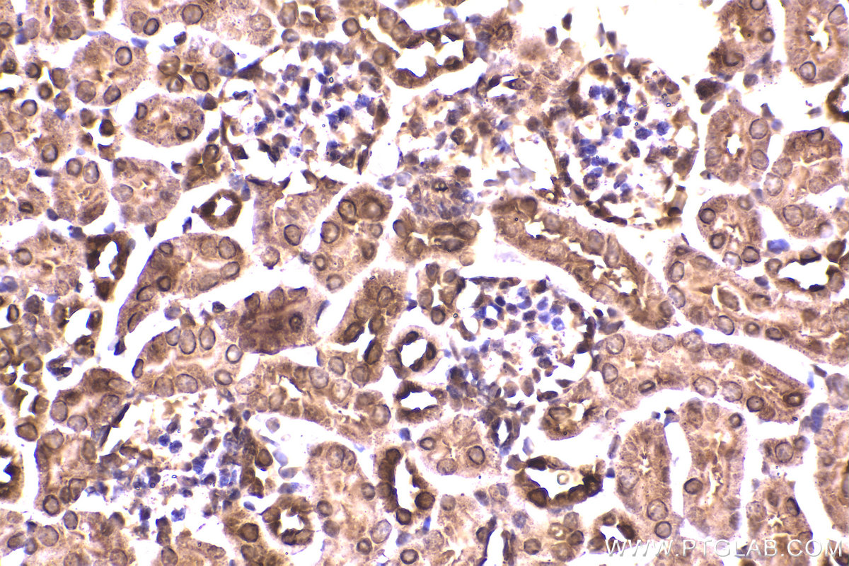 Immunohistochemical analysis of paraffin-embedded mouse kidney tissue slide using KHC2325 (HSPA2 IHC Kit).