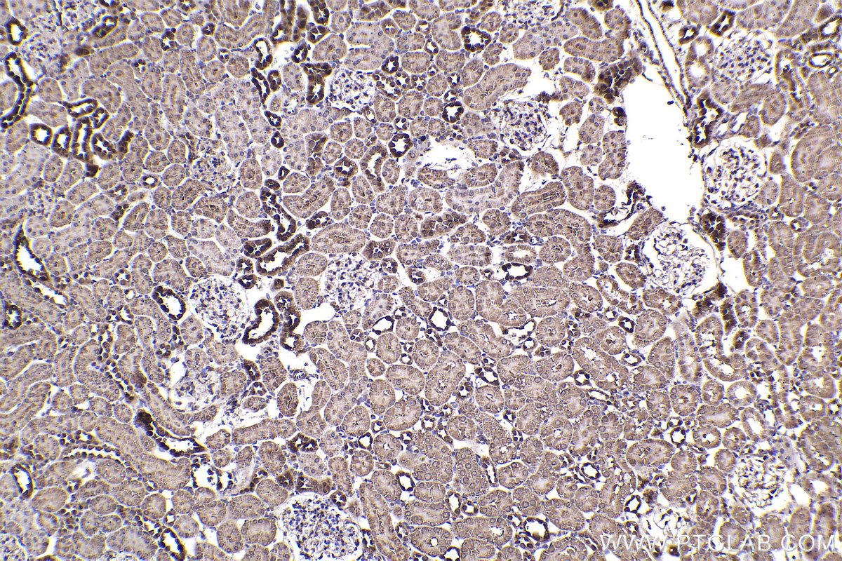 Immunohistochemical analysis of paraffin-embedded rat kidney tissue slide using KHC2325 (HSPA2 IHC Kit).