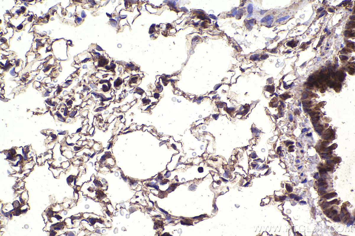 Immunohistochemical analysis of paraffin-embedded rat lung tissue slide using KHC2340 (HSPE1 IHC Kit).