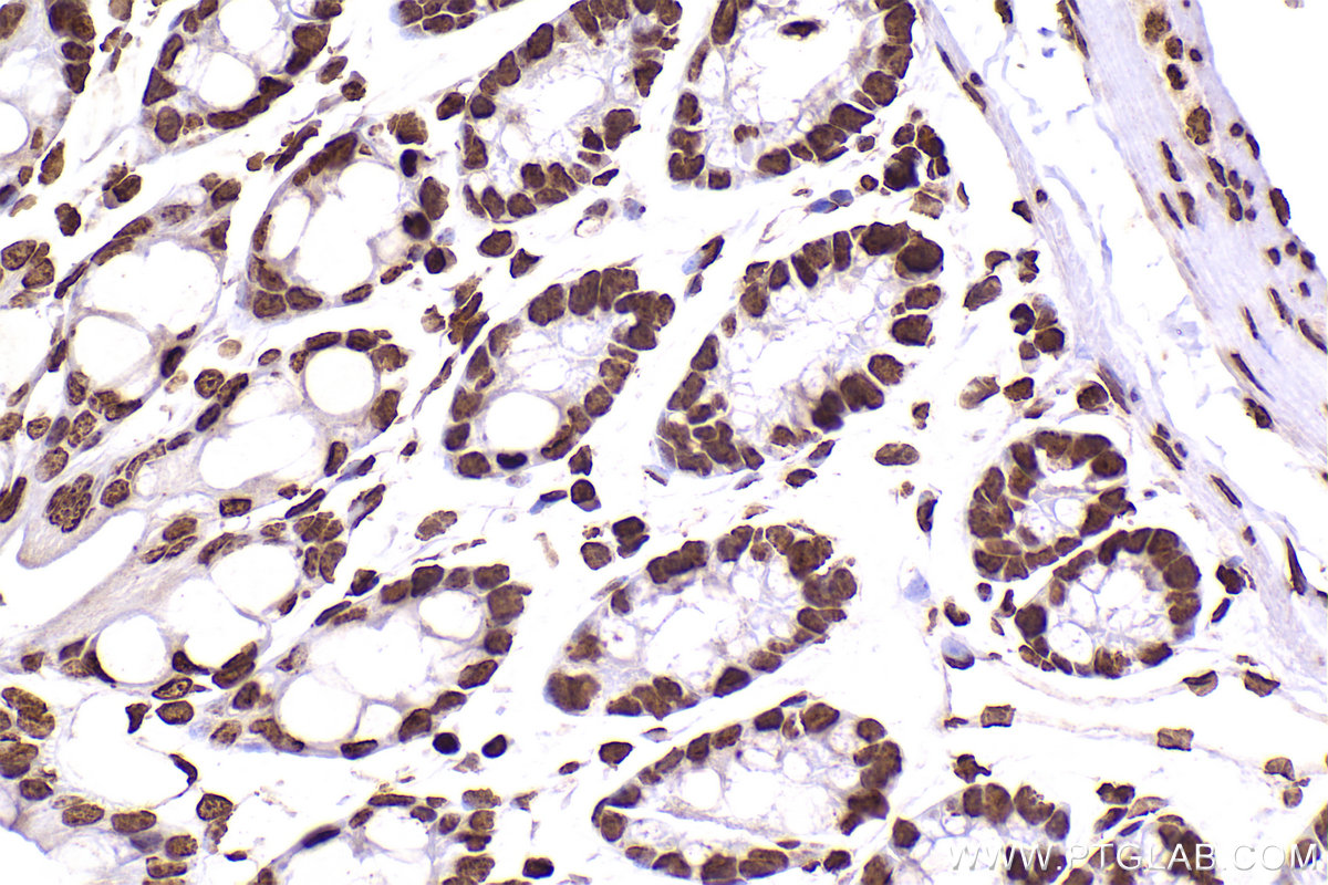 Immunohistochemical analysis of paraffin-embedded mouse colon tissue slide using KHC2506 (Histone H3.4 IHC Kit).