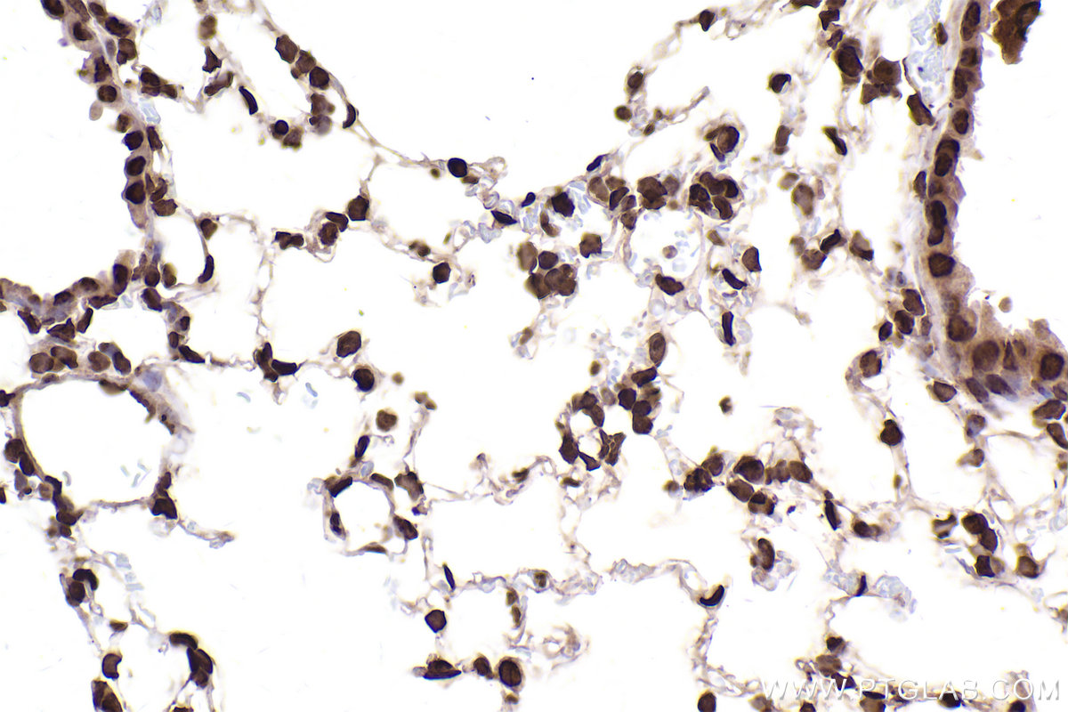 Immunohistochemical analysis of paraffin-embedded mouse lung tissue slide using KHC2506 (Histone H3.4 IHC Kit).