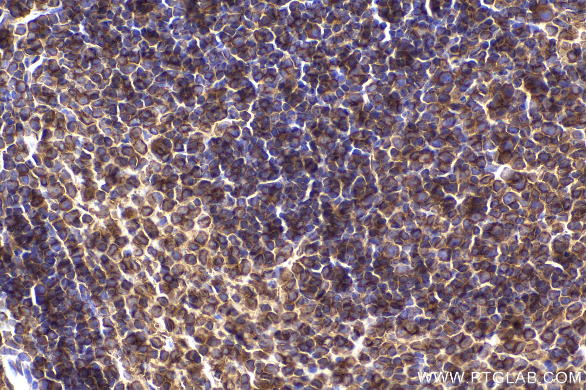 Immunohistochemical analysis of paraffin-embedded mouse spleen tissue slide using KHC2186 (IDO1 IHC Kit).