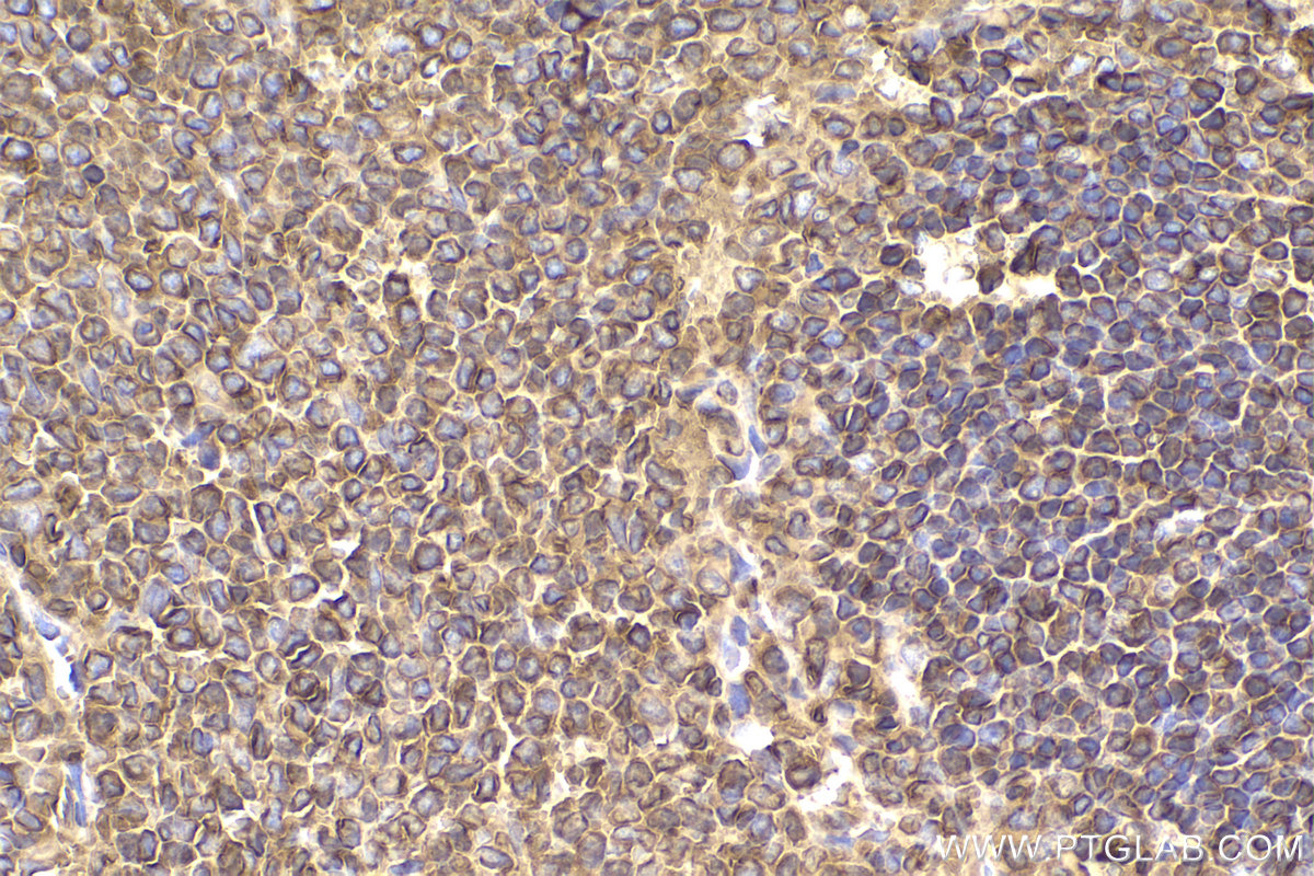 Immunohistochemical analysis of paraffin-embedded rat spleen tissue slide using KHC2186 (IDO1 IHC Kit).
