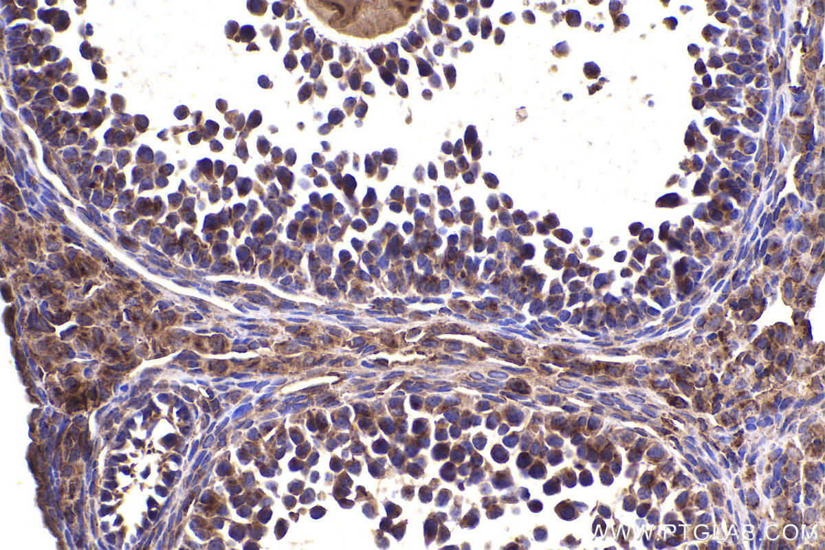 Immunohistochemical analysis of paraffin-embedded mouse ovary tissue slide using KHC2383 (IFITM2 IHC Kit).