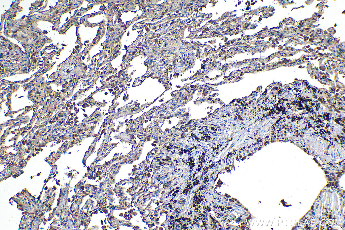 Immunohistochemical analysis of paraffin-embedded human lung tissue slide using KHC1194 (IGJ IHC Kit).