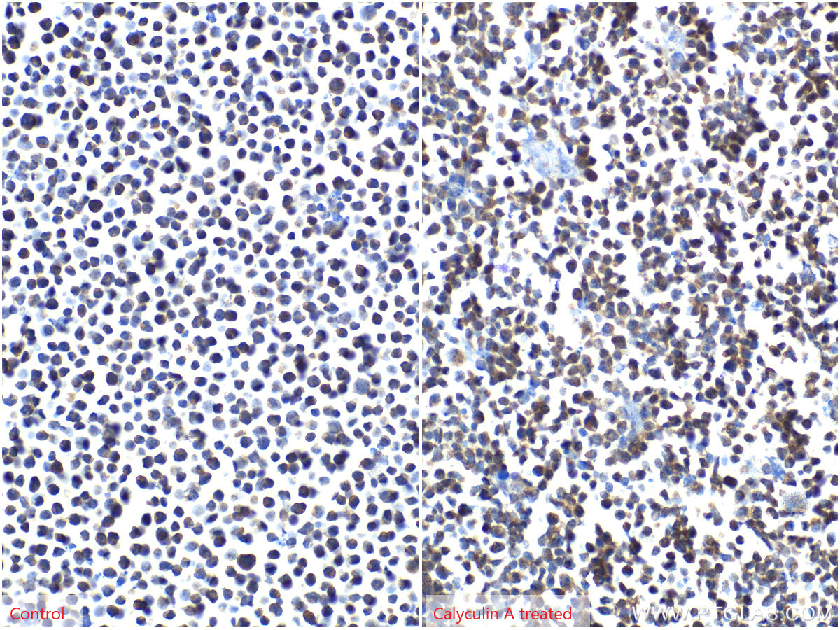 Immunohistochemical analysis of paraffin-embedded Jurkat cells slide using KHC2081 (IKBKG IHC Kit).