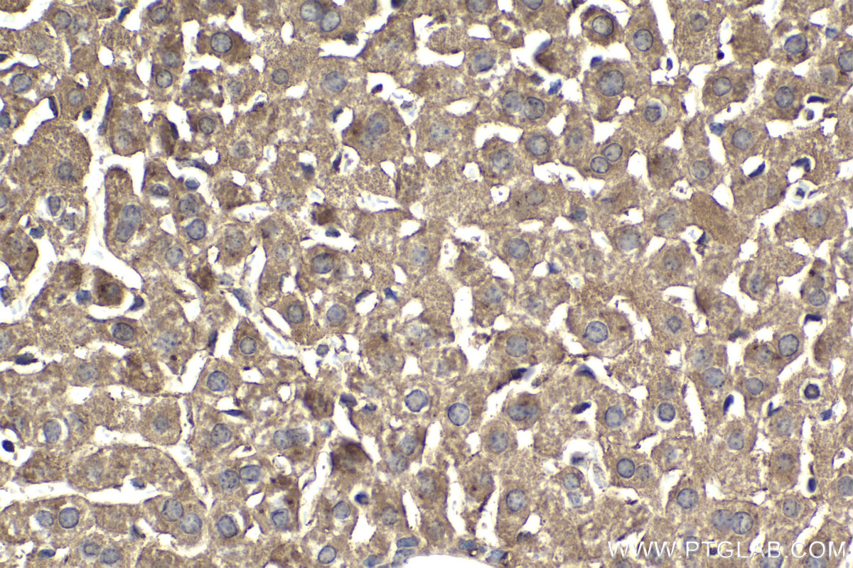Immunohistochemical analysis of paraffin-embedded mouse liver tissue slide using KHC2081 (IKBKG IHC Kit).