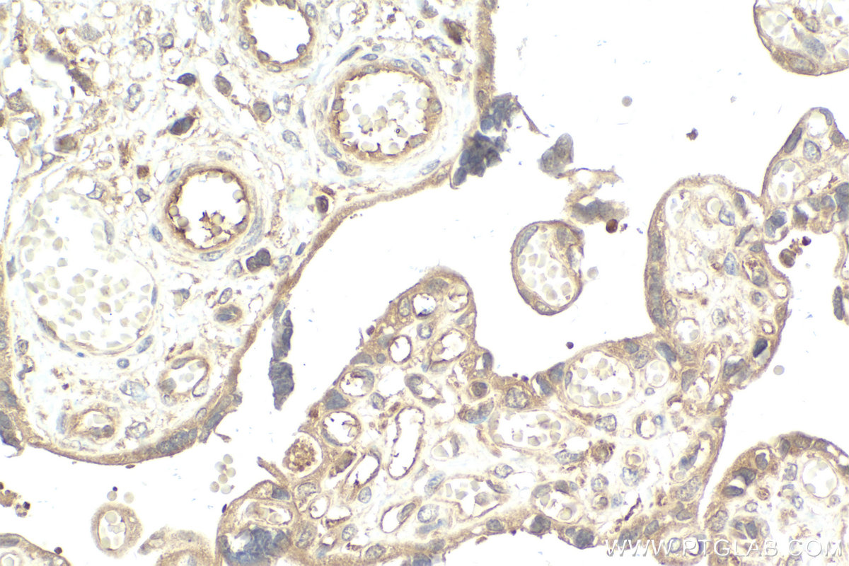 Immunohistochemical analysis of paraffin-embedded human placenta tissue slide using KHC2081 (IKBKG IHC Kit).