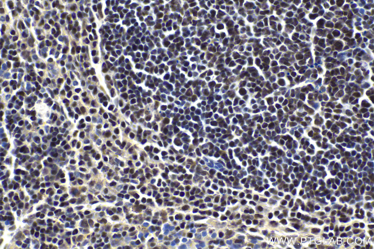 Immunohistochemical analysis of paraffin-embedded mouse spleen tissue slide using KHC1995 (IKZF3 IHC Kit).
