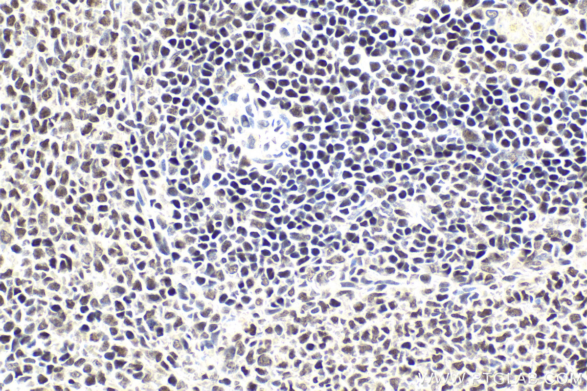 Immunohistochemical analysis of paraffin-embedded rat spleen tissue slide using KHC1995 (IKZF3 IHC Kit).