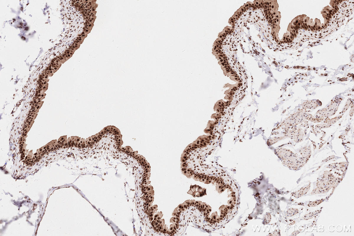 Immunohistochemical analysis of paraffin-embedded rat bladder tissue slide using KHC2573 (INTS3 IHC Kit).