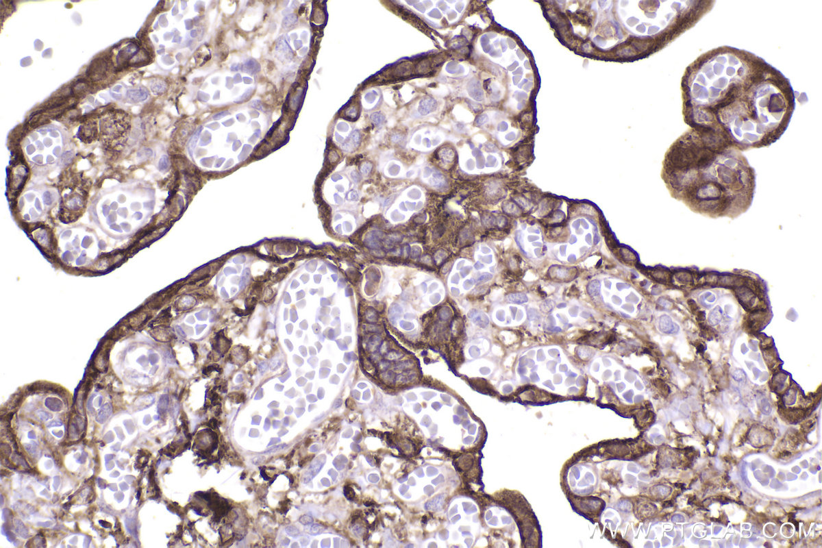 Immunohistochemical analysis of paraffin-embedded human placenta tissue slide using KHC2436 (IQGAP2 IHC Kit).