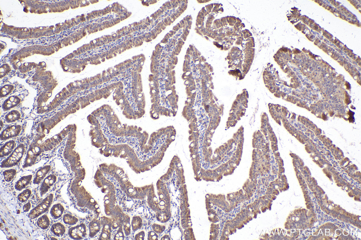 Immunohistochemical analysis of paraffin-embedded rat small intestine tissue slide using KHC2436 (IQGAP2 IHC Kit).