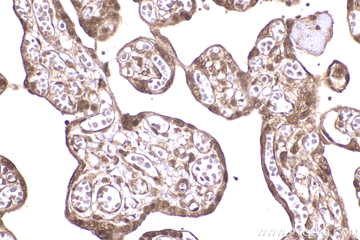 Immunohistochemical analysis of paraffin-embedded human placenta tissue slide using KHC2304 (IRAK1 IHC Kit).