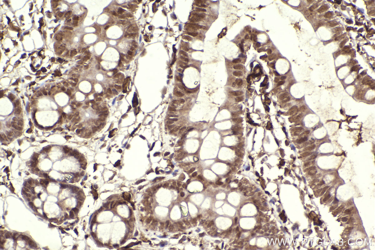 Immunohistochemical analysis of paraffin-embedded rat intestin tissue slide using KHC2304 (IRAK1 IHC Kit).