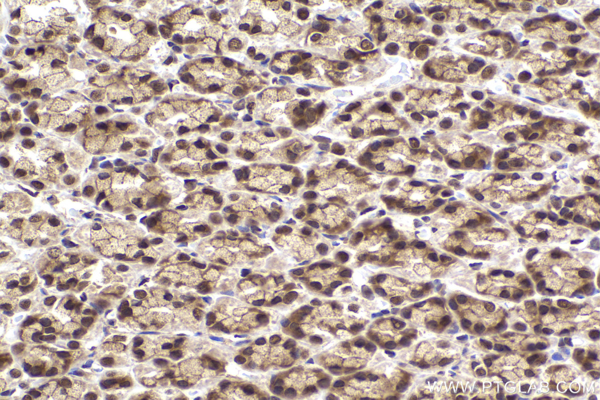 Immunohistochemical analysis of paraffin-embedded rat stomach tissue slide using KHC2176 (IRF1 IHC Kit).