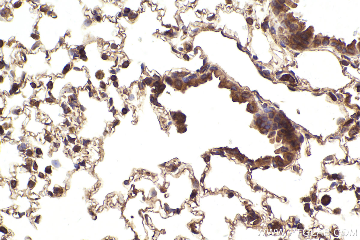 Immunohistochemical analysis of paraffin-embedded mouse lung tissue slide using KHC2322 (IST1 IHC Kit).